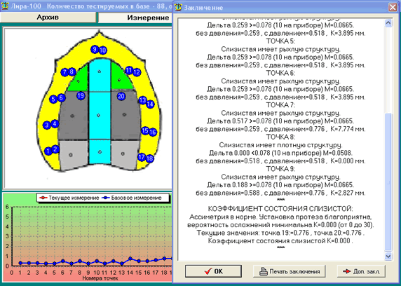 Классификация суппле картинки