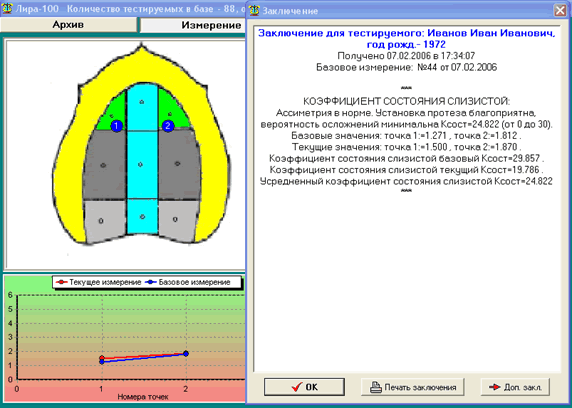 Классификация суппле картинки
